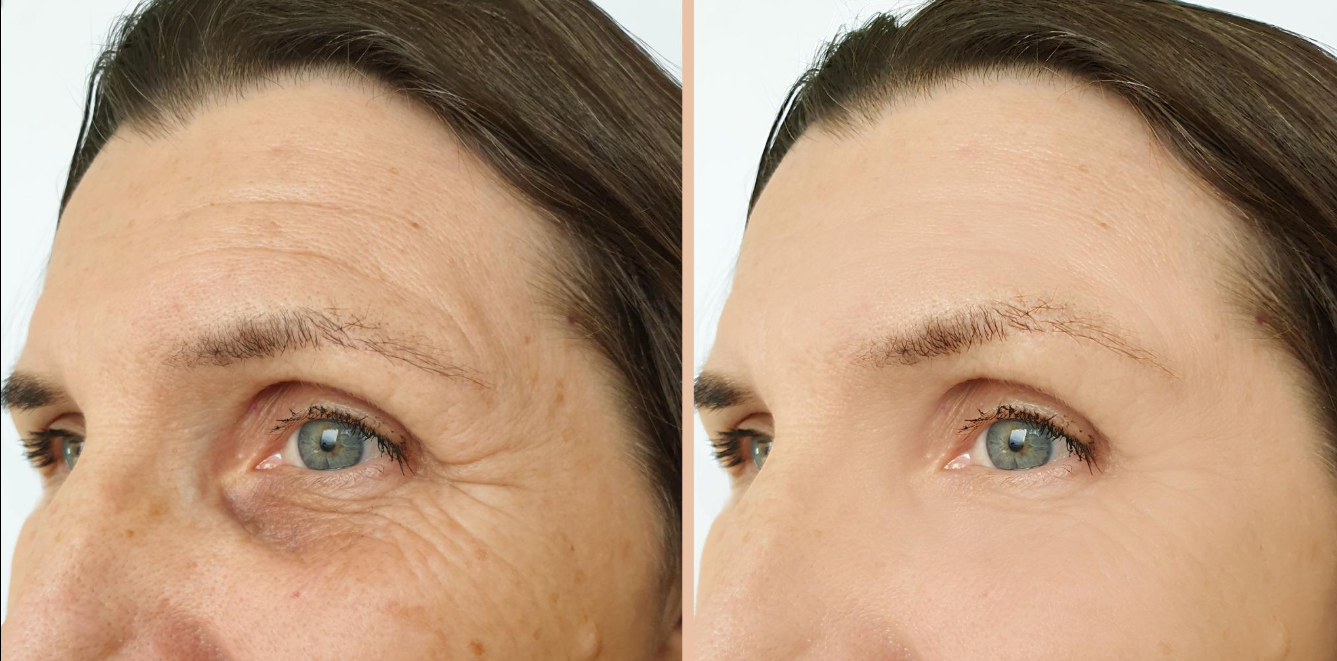 Anti-Aging Treatments
